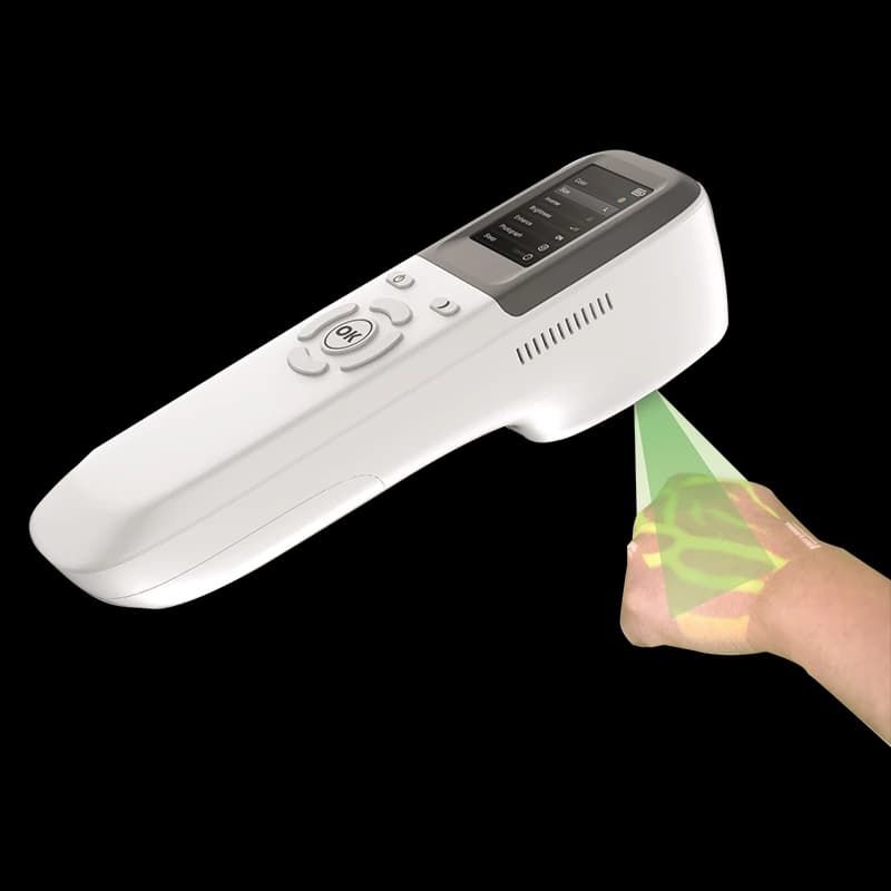 QV-600 vein finder projecting a live vein map